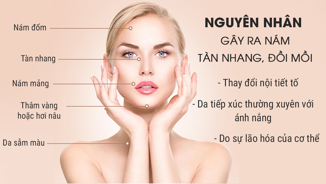 nguyen_nhan_gay_nam_da